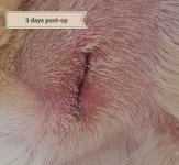 Mavis Medical Thread - Skin Tumor