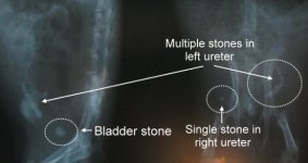 Stones x-ray sef1268-stone-sludge.jpg